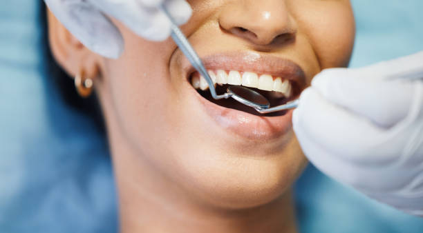 Best Urgent Care for Lost Fillings or Crowns in Shenandoah Farms, VA