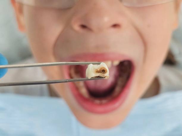 Best Emergency Gum Treatment in Shenandoah Farms, VA